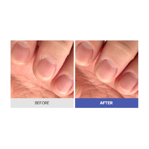 Покрытие для ногтей с матовым эффектом BANDI NAILCURE BLUE DIAA PROFESSIONAL 10 мл  